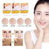 6 level Spot Remover Laser Plasma Pen Skin Care Mole Removal Dark Skin Wart Tattoo - Sabreeonline