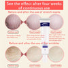 Korean Skin Repair Body Cream Soft Skin Stretch Marks Scar Removal Creams - Sabreeonline