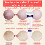 Korean Skin Repair Body Cream Soft Skin Stretch Marks Scar Removal Creams - Sabreeonline