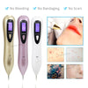 6 level Spot Remover Laser Plasma Pen Skin Care Mole Removal Dark Skin Wart Tattoo - Sabreeonline