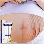 Korean Skin Repair Body Cream Soft Skin Stretch Marks Scar Removal Creams - Sabreeonline