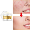 Snail Rejuvenating Face Cream Hyaluronic Acid Moisturizer Anti Aging Collagen Skin Care Health Nourishing Serum - Sabreeonline