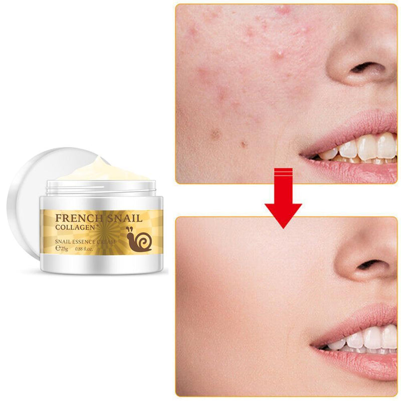 Snail Rejuvenating Face Cream Hyaluronic Acid Moisturizer Anti Aging Collagen Skin Care Health Nourishing Serum - Sabreeonline