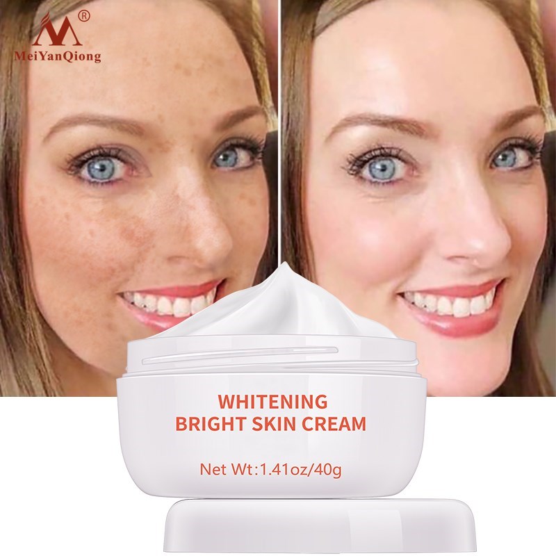 Dark Spot Remover Cream - Sabreeonline