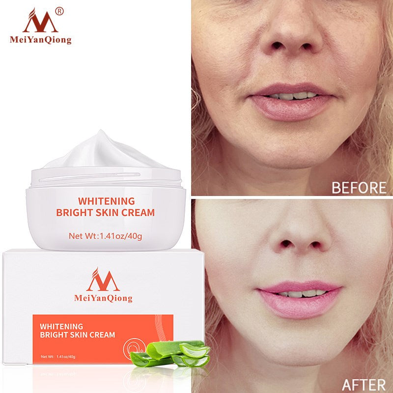 Dark Spot Remover Cream - Sabreeonline